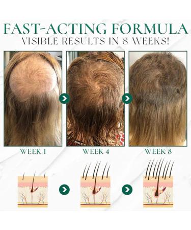  Pemarlis Sea Salt Shampoo Anti-Dandruff Shampoo Natural Shampoo for Oily Hair Deep Cleansing Moisturizing Care and Oil Control - Buy Online on GoSupps.com