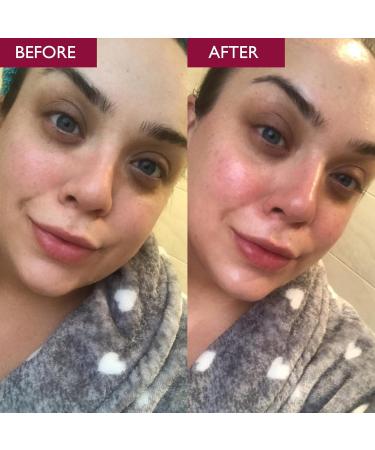SKINICIAN Advanced Pro-Radiance Enzyme Cleanser - Foaming Facial Cleanser with Anti-Ageing Properties - Gentle Facial Exfoliator - Natural AHA Cleanser - Vegan & Cruelty Free Skincare (150ml) - Buy Online on GoSupps.com
