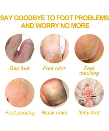 Fungal Nail Treatment For Toenails Extra Strong - Nail Fungus Treatment - Moisturize Cuticle Care Oils for Ingrown Toenails - Toenail Growth for Repairing Damaged & Discolored Nails(30ML) - Buy Online on GoSupps.com