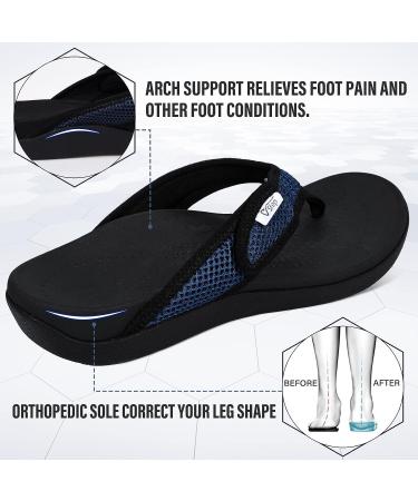 V.Step Orthopedic Flip Flops with Arch Support | Adjustable Mesh Orthotic Sandals for Plantar Fasciitis | Navy Blue - M8/W9.5 - Buy Online on GoSupps.com