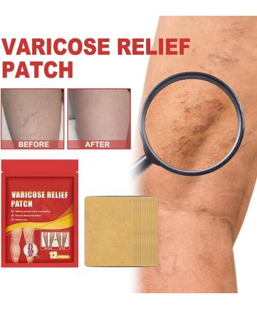 Buy Varicose Vein Plaster | 10 & 12 Piece Venous Stickers for Spider Vein Care | Reduce Appearance of Veins - Buy Online on GoSupps.com