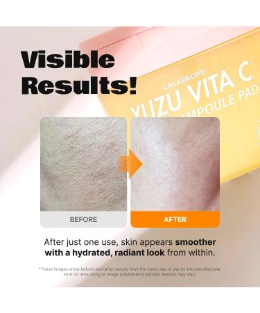 LALARECIPE Yuzu Vitamin C Toner Pads 71% Yuzu Extract with 5% Niacinamide & 12 Vitamins Exfoliating with Glutathione AHA PHA For All Skin Types Korean Skin Care 80 Pads (5.07 Fl Oz) - Buy Online on GoSupps.com