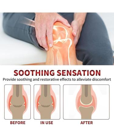 Buy Todahof Bienengift Psoriasis Treatment Cream - 3 PCs - Effective Bee Gift Cream for Psoriasis Relief | International Shipping Available - Buy Online on GoSupps.com