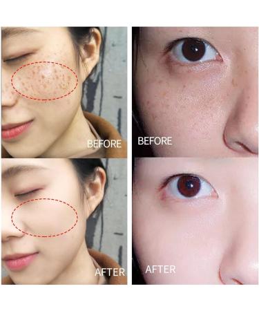 behound Glutathione White Cream Glutathione Cream Glutathione Cream for Skin Whitening Glutathione Whitening Cream Facial Dark Spots Remover 2 Pcs - Buy Online on GoSupps.com