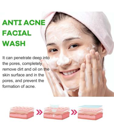 Acne-Fighting Facial Cleanser - Deep Cleanse Remove Oil Dirt Blackheads & Pimples Shrink Pores Refreshing & Comforting(2PCS) 1 Count (Pack of 1) - Buy Online on GoSupps.com