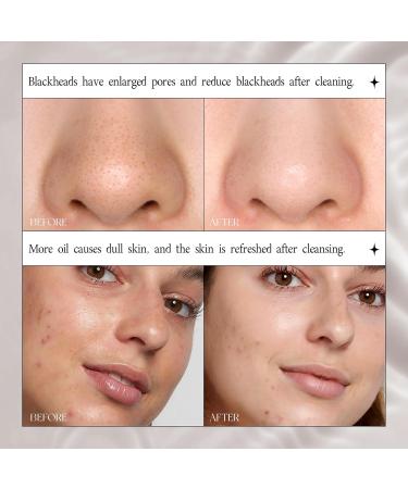 Deep Cleansing Volcanic Mud Mask Stick | Remove Blackheads & Control Oil for All Skin Types - Men & Women - Buy Online on GoSupps.com