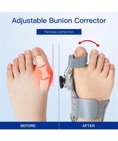 Zeetan Bale Toe Corrector - Adjustable Button Orthopedic Large Toe Relief with Heel Straps - Comfortable Foot Care Solution - Buy Online on GoSupps.com