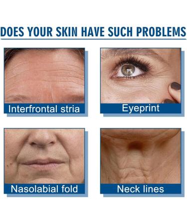 Retin-ol Colla-gen Cream With 5% Hyaluronic Acid Anti Aging Cream Anti Wrinkle Face Cream Hyaluronic Acid Moisturizer Nourishing Face Cream For Effective Wrinkle Smoothing Night Cream For Women - Buy Online on GoSupps.com