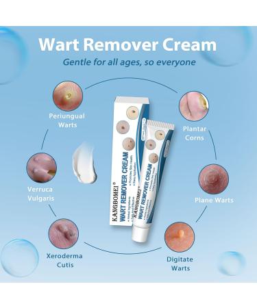 Cr me anti-verrues kit d' limination des acrochordons convient aux mains et aux pieds (20g) Cr me anti-verrues 20g - Buy Online on GoSupps.com