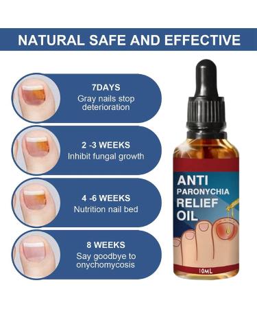 Ingrown Toenail Treatment Correction Drops Nail Growth Treatment Nail Care Ingrowing Toenail Treatment Ingrown Toenail Corrector Treatment for Ingrown Toenail Ingrowing Toenail Improve Toenail Health - Buy Online on GoSupps.com