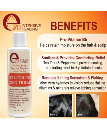 Salicylic Shampoo & Conditioner Set for Folliculitis Dandruff & Oily Scalp - Paraben-Free Herbal Treatment for Scalp Health & Hair Repair - Buy Online on GoSupps.com