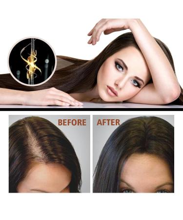 Organic Batana Oil Hair Treatment Conditioner - 120ml | Hair Growth Botanical Extracts & Vitamins for Healthier Thicker Hair - Buy Online on GoSupps.com