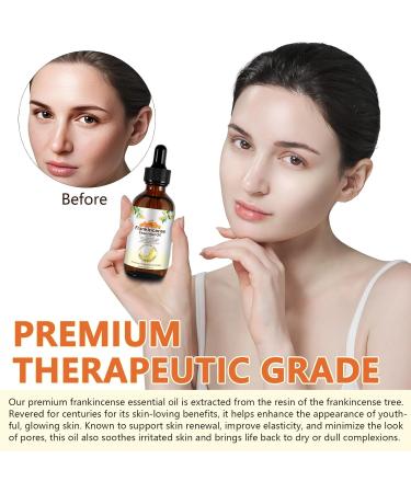 Frankincense Essential Oil Pure & Natural Premium Frankincense Oil for Face Hair Care Body Home Diffusers Aromatherapy Massage and Humidifiers 2.02 Fl.Oz/60 ML 2.02 Fl Oz (Pack of 1) - Buy Online on GoSupps.com