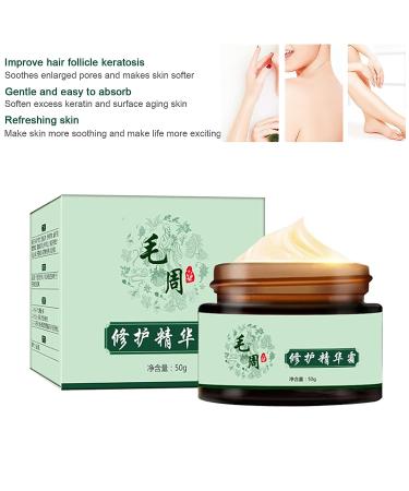 Dioche Keratosis Pilaris Cream 50g - Exfoliating Treatment for Rough & Bumpy Skin - Buy Online on GoSupps.com
