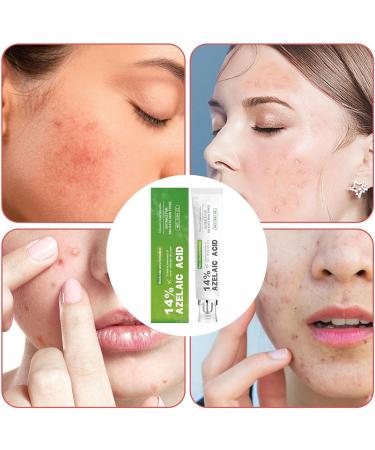  G n rique Facial Moisturizer | Anti-Blemish Cream 30 Grams | Facial Pore Minimizer | For Men and Teenagers For Travel Home and Daily Use - Buy Online on GoSupps.com