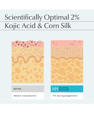 Kojic Acid Serum for Face - 2% Pure Kojic Acid with Ferulic Acid, Aloe Vera, Vitamin E - Skin Brightening Formula for Dark Spots, Discoloration, Hyperpigmentation - Buy Online on GoSupps.com