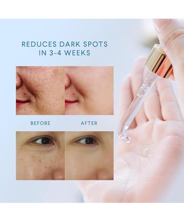 Dark Spot Remover Serum with Kojic Acid for Face & Body - 1 FL OZ | For Women & Men - Buy Online on GoSupps.com
