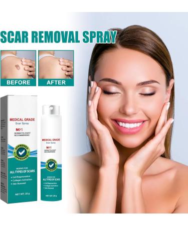 Proregen Scar Spray - Medical Grade Scar Remover for All Types of Scars (2PCS) - Buy Online on GoSupps.com