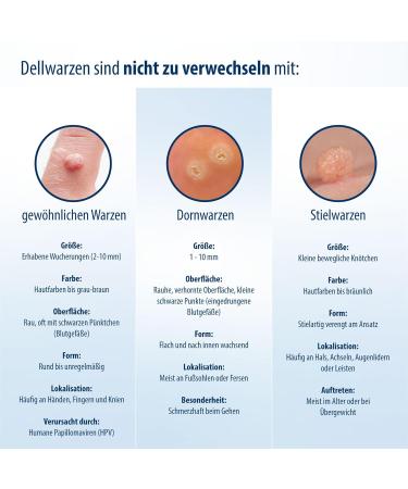 Evolsin Molluscum Warts Agent I For Adults & Children from 2 Years Gentle & Effective Molluscum Warts Treatment - 0.16 Oz - Buy Online on GoSupps.com