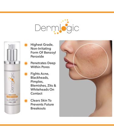Maximum Strength Benzoyl Peroxide 10% Face & Body Wash for Acne - Clears Pores on Contact, Soothes Skin - 10 oz - Buy Online on GoSupps.com