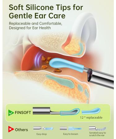 Ear Wax Removal Tool Camera | 1296P HD Ear Cleaner Kit with 10 Picks & 6 LED Lights for iOS & Android - Olive Green - Buy Online on GoSupps.com