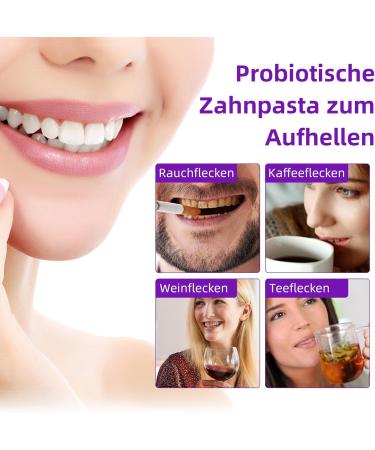 SP-7 Probiotic Toothpaste | Brightening & Stain Removal Fresh Breath Gum Protection - International Shipping Available - Buy Online on GoSupps.com