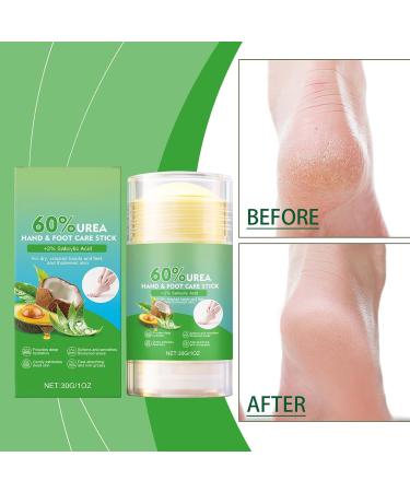 Balm for the feet repairing balm moisturizing suitable for and cracked heels hands knees elbows dead skin and pedicure for women for use at night - Buy Online on GoSupps.com