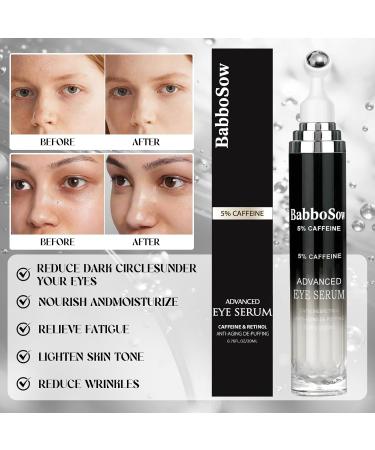 S rum pour les Yeux 20ml Rouleau Sous les Yeux Soin Contour des Yeux avec Rouleau avec Caf ine Acide Hyaluronique Niacinamide Peptides Anti Cernes Poches et Rides Noir-A - Buy Online on GoSupps.com