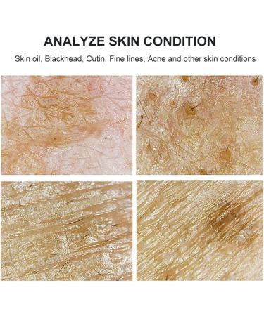 7 Inch Skin Diagnosis Hair Analyzer Scalp Hair Follicles Detector with Dual Probes 200x 50x High-Definition Lens with 2 Million Pixels for Imaging for Beauty Salon Hair Salon - Buy Online on GoSupps.com