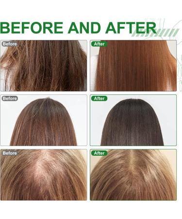 ACAREY Batana oil for hair cold pressed 100 ml hair growth natural acceleration Batana Oil Organic with scalp massage brush for moisturizing and repairing dry damaged hair 2 2 pieces - Buy Online on GoSupps.com