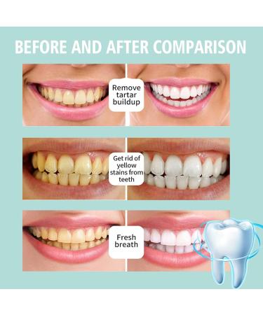 Foam Toothpaste - Deep Cleaning for Stains/Teeth Yellowing Gum Care Fresh Breath Easy to Use(2PCS) - Buy Online on GoSupps.com