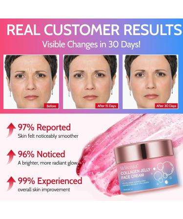 MasaiGGe Collagen Jelly Cream for the Face moisturizing antiaging facial cream with collagen improves skin elasticity intensive hydration youthfullooking skin - Buy Online on GoSupps.com