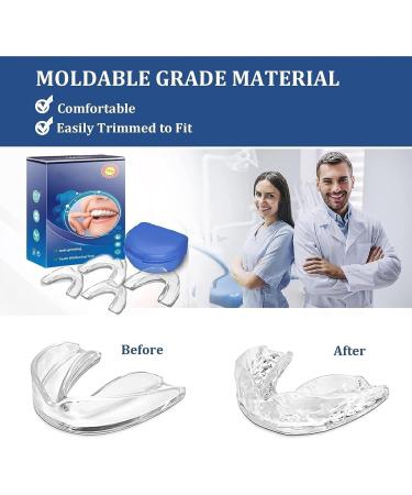 Mouth Guards for Teeth Clenching & Grinding - Reusable & Easy to Use - International Shipping - Buy Online on GoSupps.com