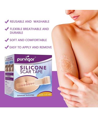 Medical Grade Silicone Scar Sheets - 1.6 x 60 Reusable Gel Tape for Acne, C-Section, Keloid Surgery Scars Treatment - Buy Online on GoSupps.com