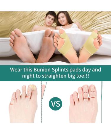 DYKOOK Bunion Corrector & Big Toe Straightener with Heel Strap for Pain Relief - 1 Pair Split Toe Separator for Hallux Valgus Corrector - Non-slip Bunion Protector - Beige (Small) - Buy Online on GoSupps.com
