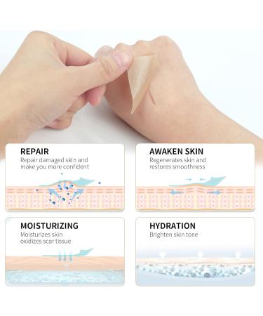 MQUPIN Silicone Scar Tape Roll (1.6 x 60 ) Silicone Scar Sheets Silicone Tape Reusable for C-Section Surgical Scar Keloid Acne Scar and Burn Scar - Buy Online on GoSupps.com