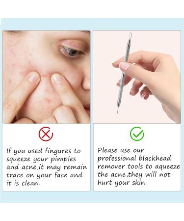 2-in-1 Facial Milia & Whitehead Extractor Tool for Pimple Acne Removal - 2pcs - Buy Online on GoSupps.com