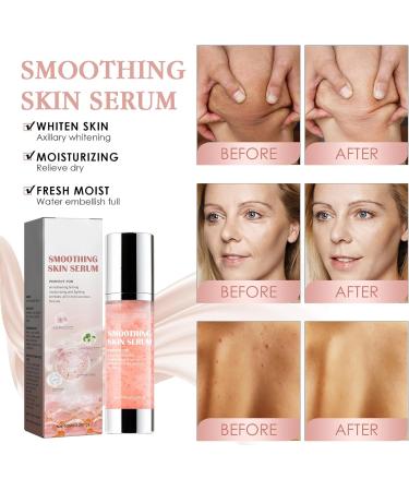 Anti Wrinkle Body Serum Smoothing Body Serum Hyaluronic Acid Face Serum for Aging Skin Firming Body Lotion Reduce Back Acne & Fine Lines Body Moisturizer for Dry Skin Hydrating Serum for Body & Face - Buy Online on GoSupps.com