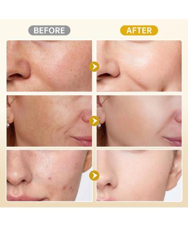 BOLI Kojic Acid Cream, Dark Spot Remover, Azelaic Acid + Salicylic Acid + Niacinamide + Retinol Peptides Skin Brighetning Cream (3.52 oz) 5.29 Ounce (Pack of 1) - Buy Online on GoSupps.com