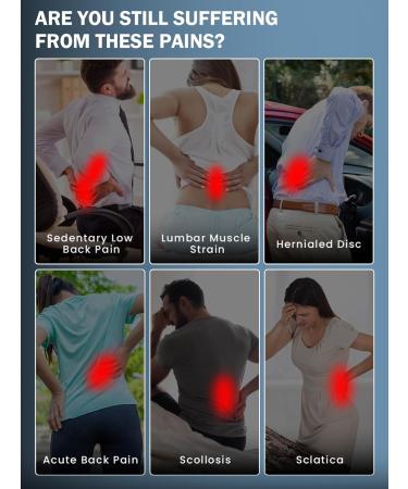 SYXUPAP Back Support Belt - Adjustable Back Brace for Lower Back Pain Relief Sciatica & Herniated Disc (S: 17 -24 Waist Up to 100lbs - Buy Online on GoSupps.com