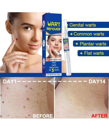 Skin Spot Removal Pen | Pack of 2 x 4ml Pens for Body Care | Gentle Non-Greasy Portable Liquid for Body and Face - Buy Online on GoSupps.com