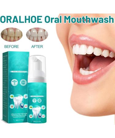 Teeth Whitening Mouthwash Teeth Total Care Mouthwash Helps with Fresh Breath Teeth & Gum Health & More Deep Cleaning of Teeth. (1pcs) - Buy Online on GoSupps.com