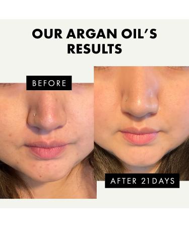 Organic Argan Oil for Hair, Skin, Nails & Face - 100% Pure Moroccan Oil - Moisturizing & Repairing Cold Pressed Aceite De Argan for Women & Men - Buy Online on GoSupps.com