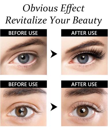 Eyelash Growth Serum - Eyelash Serum for Growth and Thickness - Lash Growth Serum - Moisture Activate Thicker Fuller Natural Looking - Strengthen Longer Curly Enhancer Boost Extension Stimulate Dense - Buy Online on GoSupps.com