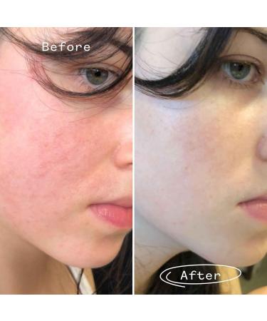 PAI SKINCARE The Light Fantastic Organic Ceramide Face Oil | Natural Vegan Sensitive Skincare - 30 mL - Buy Online on GoSupps.com