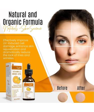 20% Vitamin C Serum - Organic Anti-Aging Facial Serum with Hyaluronic Acid Retinol & Vitamin E - Boost Collagen & Hydrate Skin 1 Fl Oz - Buy Online on GoSupps.com