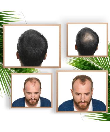 Hair Loss Concealer I Light Grey (Fixing + Fibers) I - Buy Online on GoSupps.com