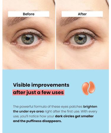 Plantifique Superfood Under Eye Masks Anti Wrinkle 12 Pairs Under Eye Patches with Hyaluronic Acid Green Tea Collagen for Dark Circles and Puffiness - Puffy Eyes Skincare Gel Patches for Women & Men - Buy Online on GoSupps.com
