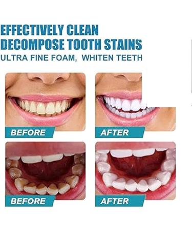Sp-6 Ultra Whitening Sp 6 Toothpaste Sp - 6 Ultra Whitening Toothpaste Deep Cleaning Care Toothpaste Sp 6 Probiotic Whitening Toothpaste Fresh Breath (Color : 2pcs Blu - Buy Online on GoSupps.com
