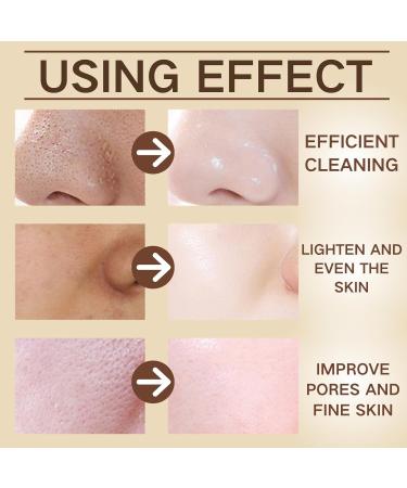 Niacinamide Peel Off Face Masks - Face Masks Beauty - Face Masks Skincare fpr Women - Hydrating Face Mask for Deep Cleaning - Face Peel Mask with Cocoa Seed Butter - Buy Online on GoSupps.com